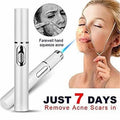 Blue Light Acne Pen: Portable Spot Treatment Device