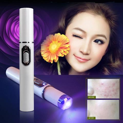 Blue Light Acne Pen: Portable Spot Treatment Device