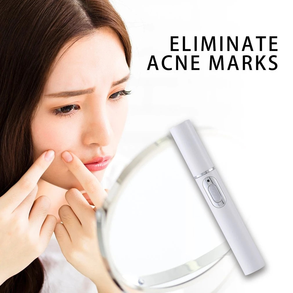 Blue Light Acne Pen: Portable Spot Treatment Device